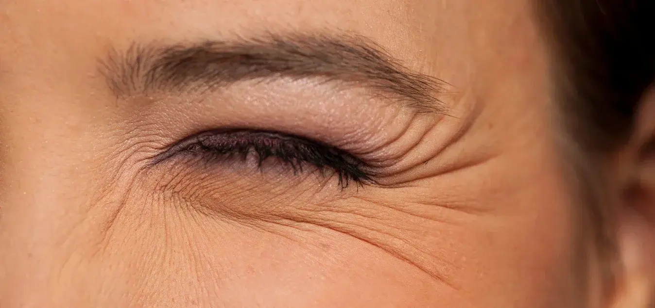 پوست جوان با چربی طبیعی و بدون چین‌وچروک