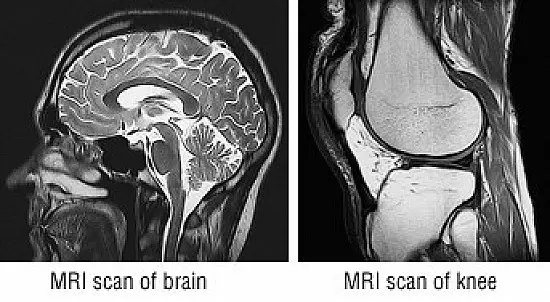 تصویر نمونه‌ای از دستگاه MRI که در بیمارستان‌ها برای تشخیص دقیق بافت‌های نرم استفاده می‌شود