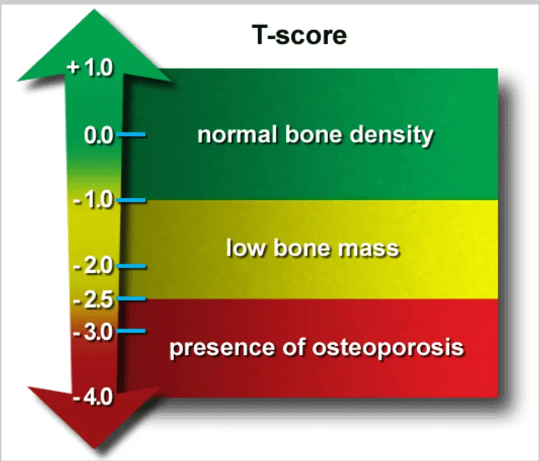 نمودار تفسیر نتایج T-score در آزمایش چگالی استخوان