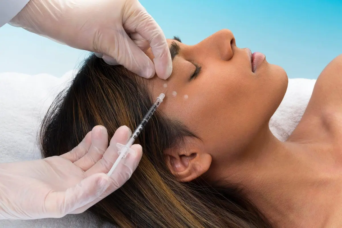 نمونهای از نتایج طبیعی و زیبایی پس از تزریق بوتاکس