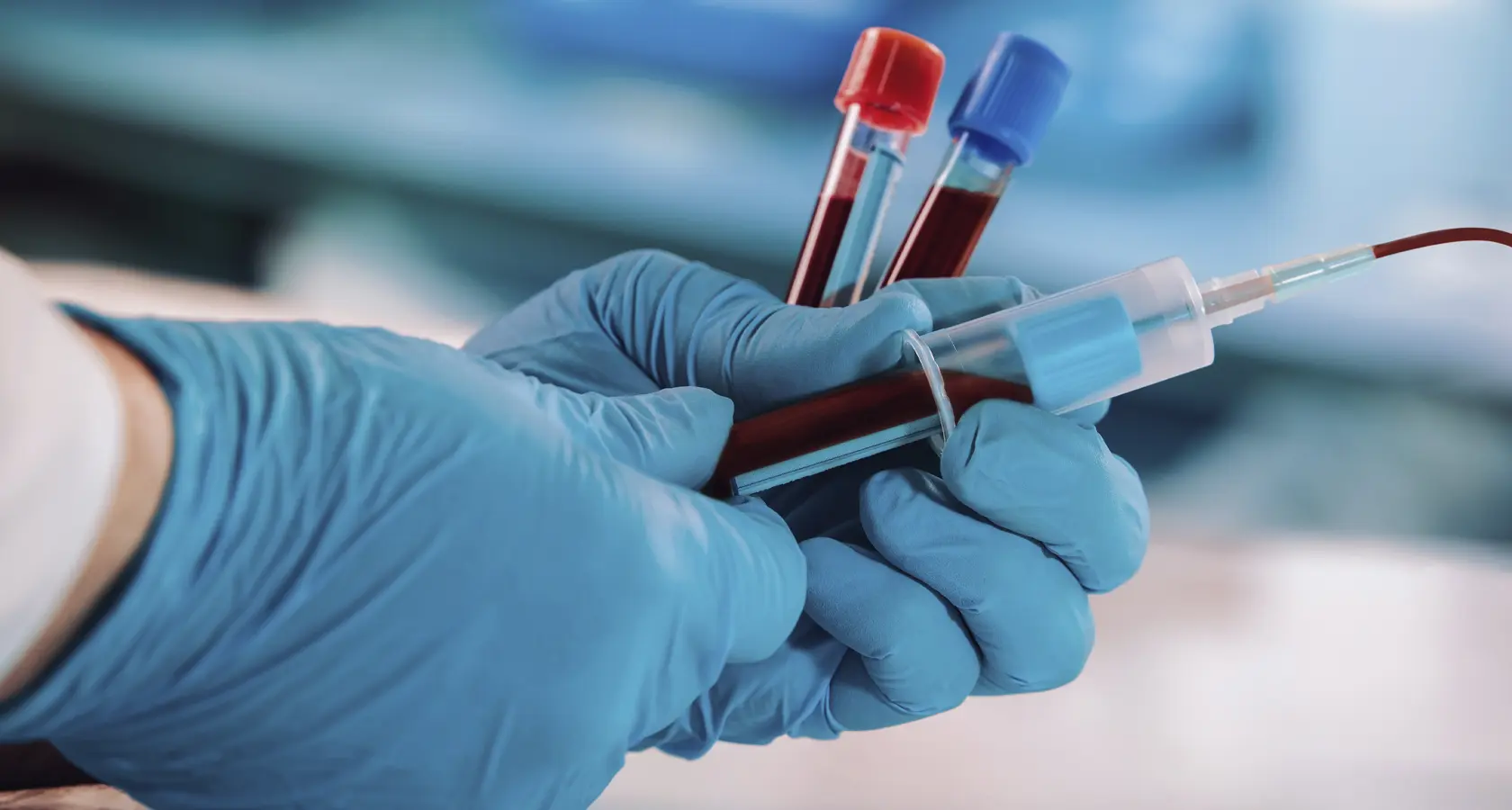 نمونهای از نمودارهای کنترل قند خون و HbA1c در بیمارستان