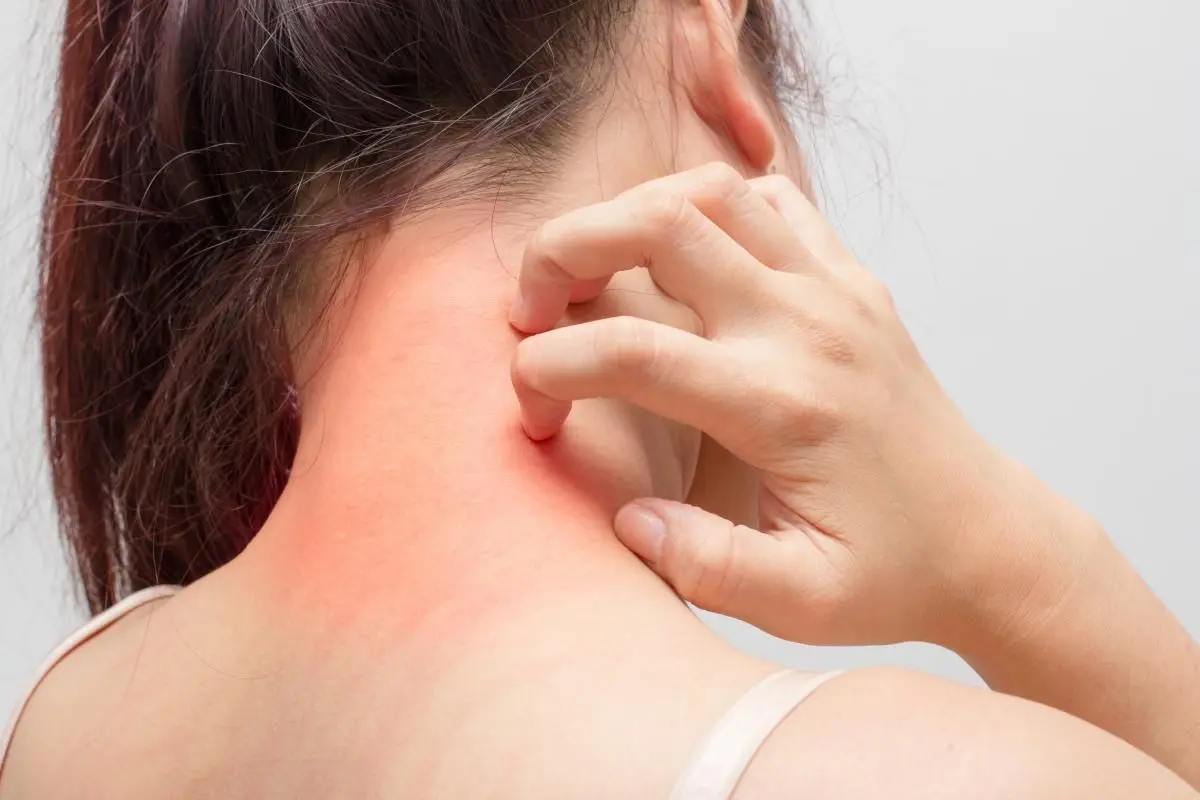 کرم مرطوبکننده پوست برای کاهش خشکی و خارش