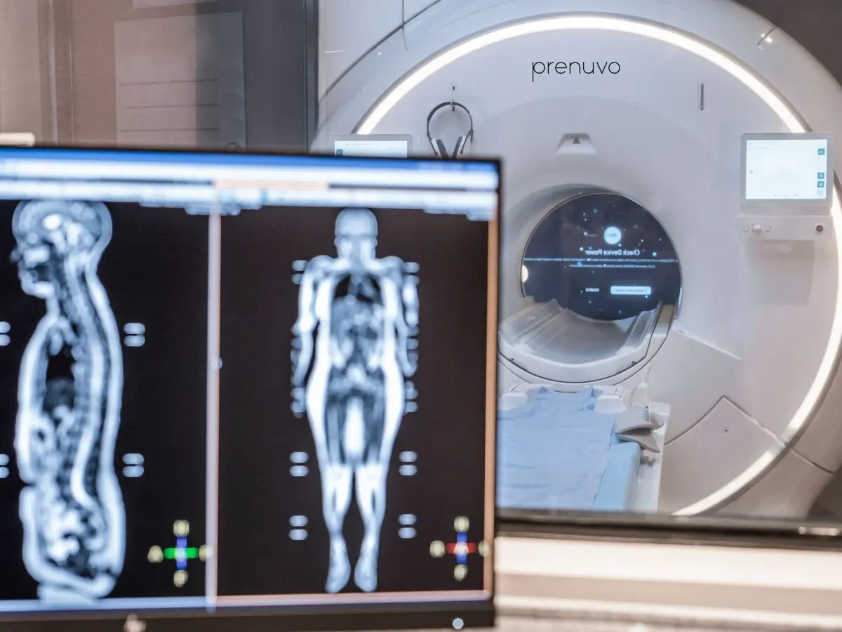 MRI چیست و چه تفاوتی با سی‌تی‌اسکن دارد؛ یک راهنمای کامل برای تصمیم بهتر