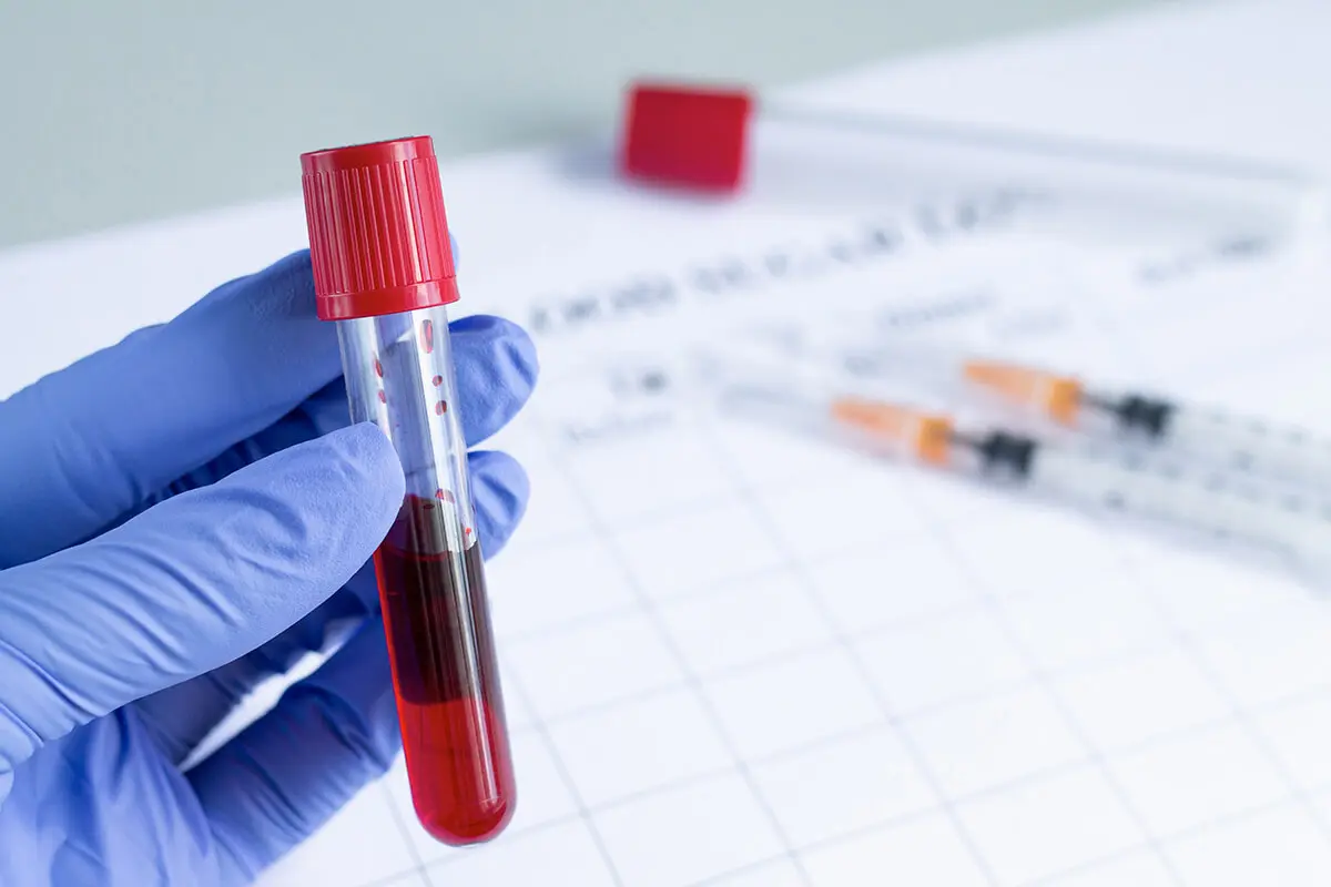 HbA1c چیست و چه کاربردی دارد؛ نکات مهم و کاربردی