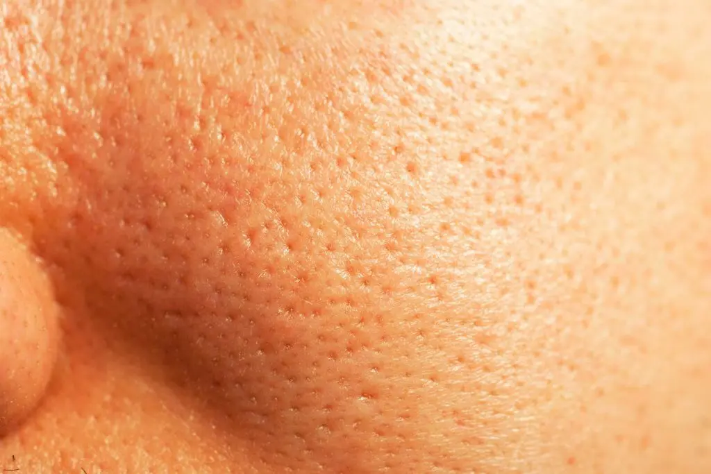 چین‌وچروک پوست از چه سنی شروع می‌شود؛ راهنمای ساده برای شروع